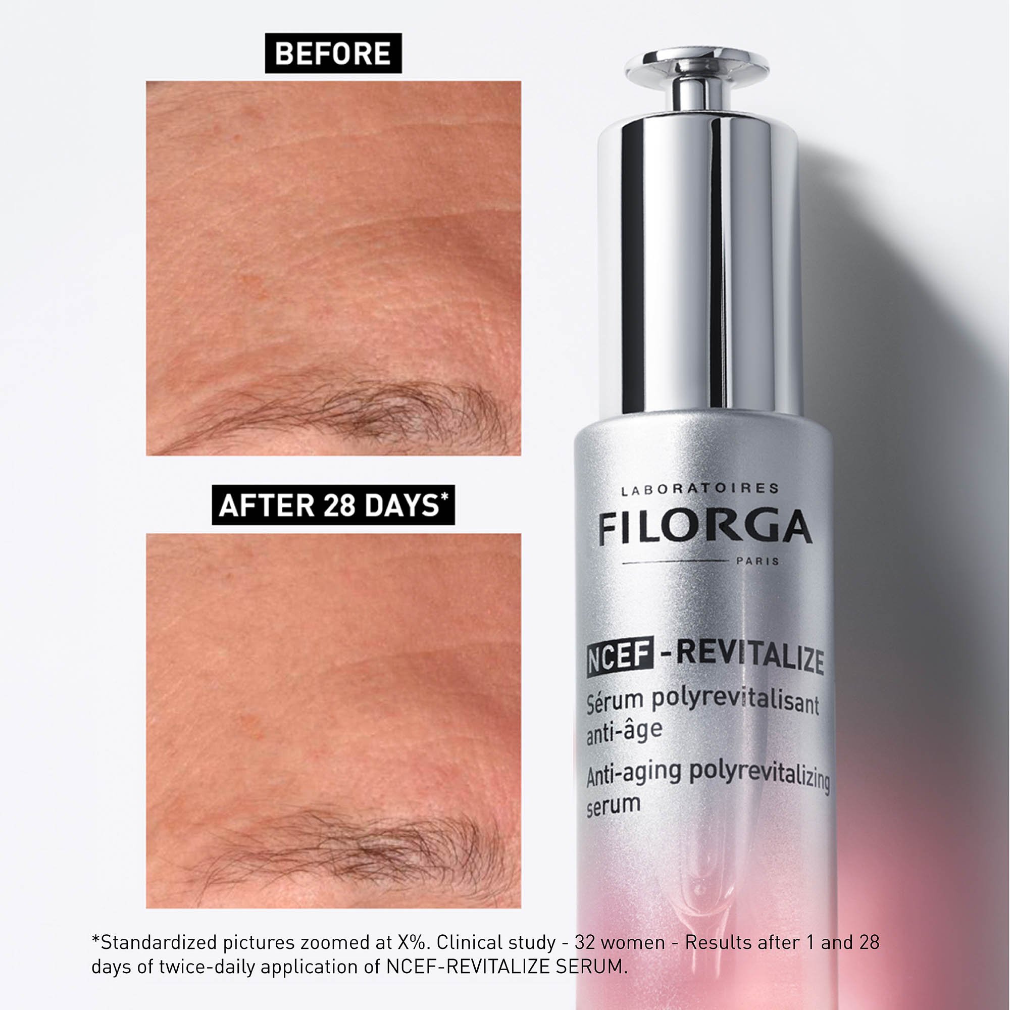 FILORGA NCEF-REVITALIZE SEERUM VÄSINUD NÄONAHALE 30ML